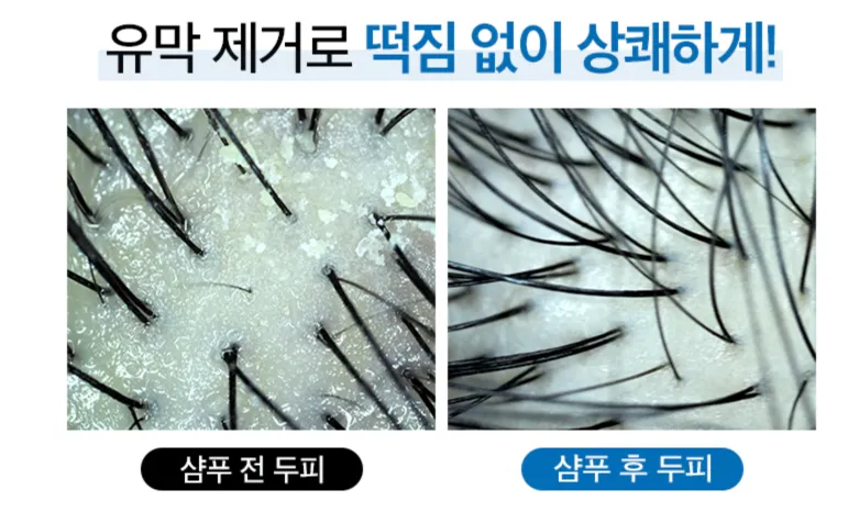 토소웅 글라이신 샴푸 후기, 탈모 샴푸 추천 (내돈내산) 7 토소웅 글라이신 샴푸 후기